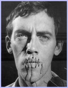 wojnarowicz_stitches