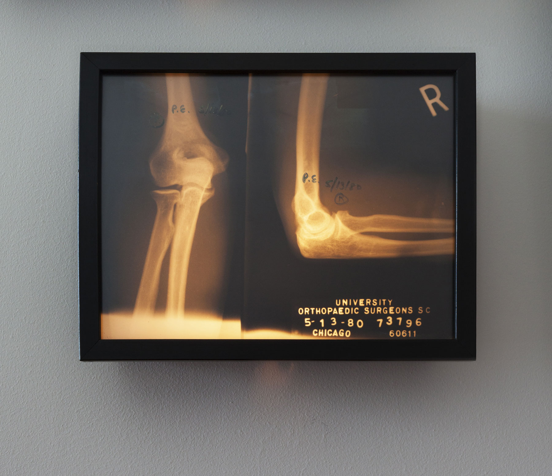 5 Questions: Patricia Erens